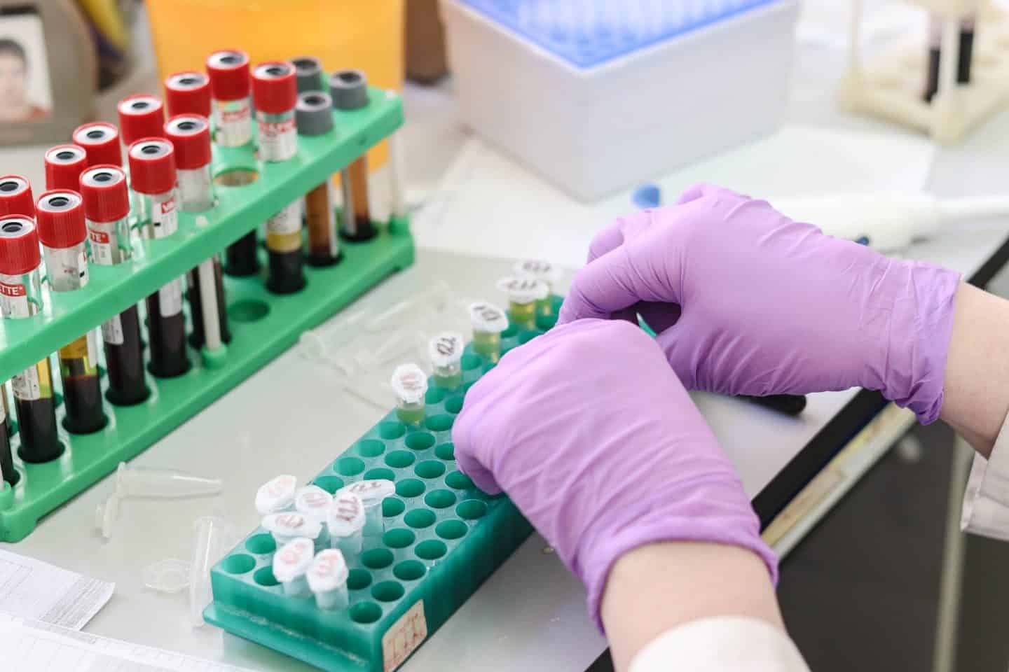 Gloved hands handling samples of some liquid in test tubes