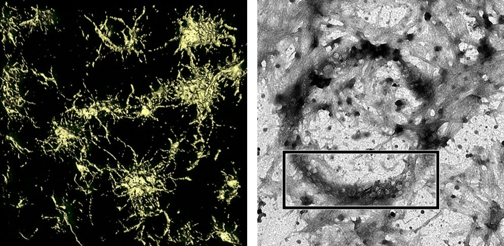 Pictures under a microscope. Left – tendrils of fluorescent fibrils begin to interconnect droplets; Right – electron microscopy confirms the origin of fibrils at the surface of droplets